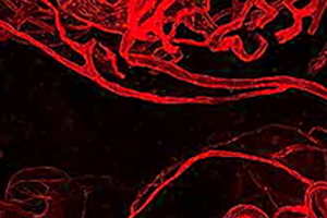 Angiogenesis